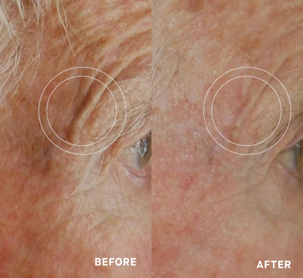 OS-01 Face Moisturizer One Skin