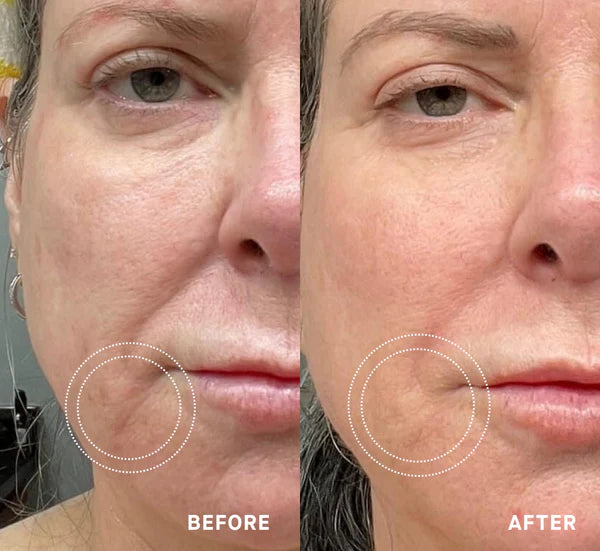 OS-01 Face Moisturizer One Skin